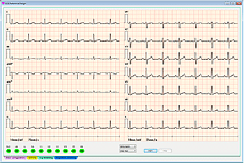 基于ADAS1000系列的12导联ECG测量系统