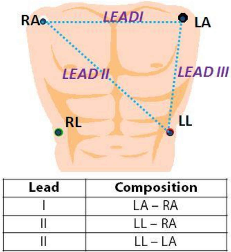 Transthoracic Impedance Measurements in Patient Monitoring Analog Devices