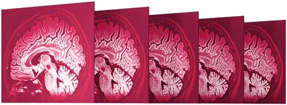 CT scanning