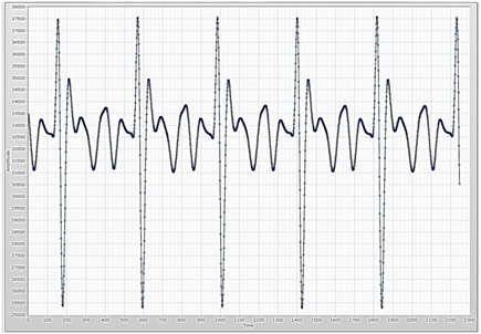 Two electrodes measurement