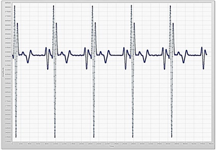 Three electrodes measurement