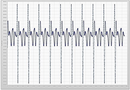 Three electrodes measurement