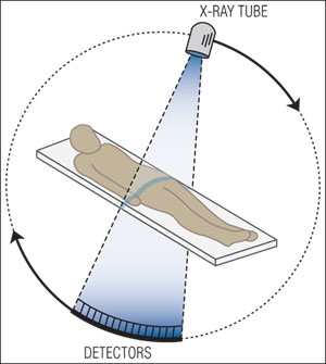 The patient is exposed to a fan-shaped x-ray beam and the projected image is detected on a thin, semi-circular digital x-ray detector.