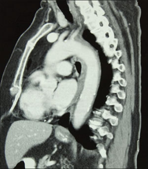 Computed tomography (CT) medical-imaging system image.