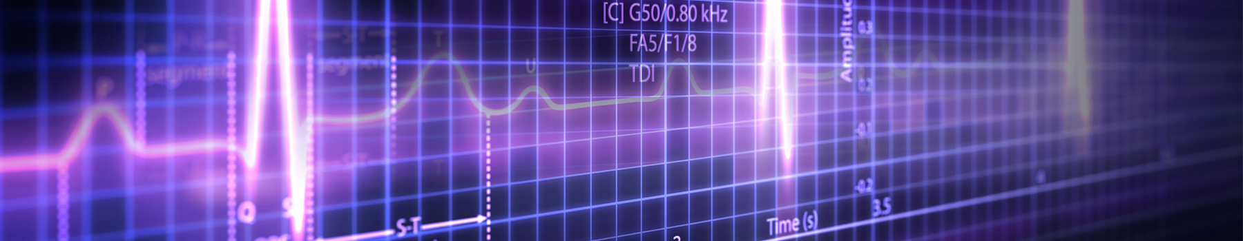 Purple digital EKG graph with stats