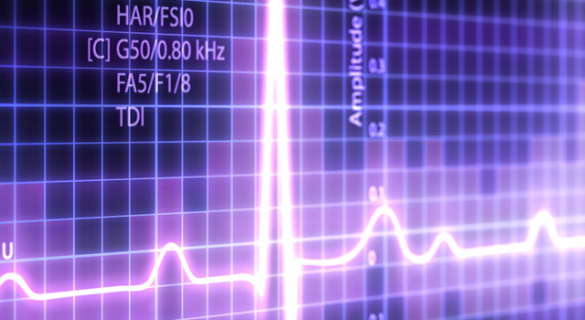 Purple digital EKG graph with stats