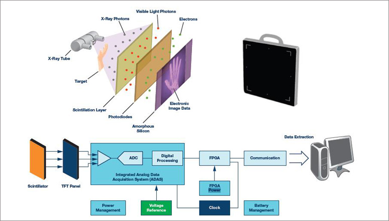 apm-medical-x-ray-imaging-pic