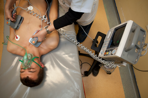 A hospital-style defibrillator with paddles. Note that there is an external electrocardiograph (ECG) or heart monitor on the patient, as evidenced by the white circles (electrodes) and leads (wires) on the chest. A hospital-style defibrillator with paddles. Note that there is an external electrocardiograph (ECG) or heart monitor on the patient, as evidenced by the white circles (electrodes) and leads (wires) on the chest.